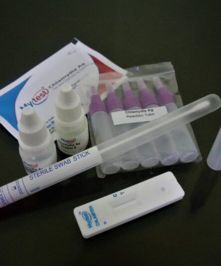 Chlamydia Ag Test