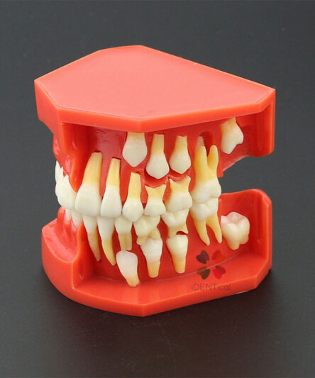 base_4