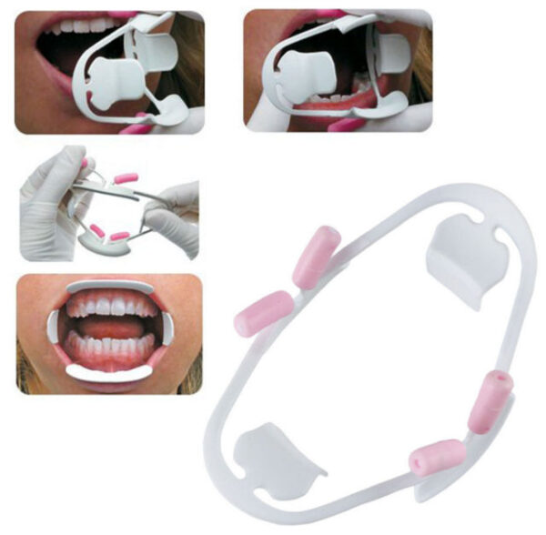 EiTi Optiview 3D Cheek and lip Retractor