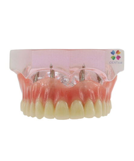 iDENTical Dental Model for Overdenture Maxilla M6001