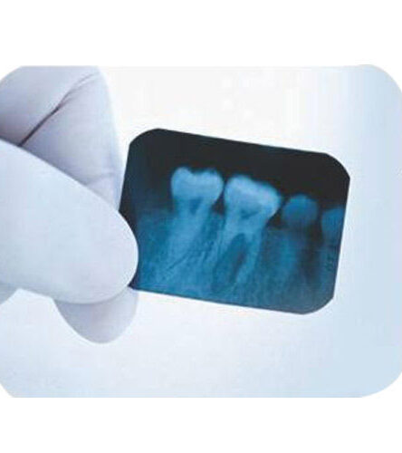 dental_avenue_self_developing_xray_1