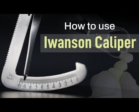 iwanson-caliper-metal-0-10mm-packet