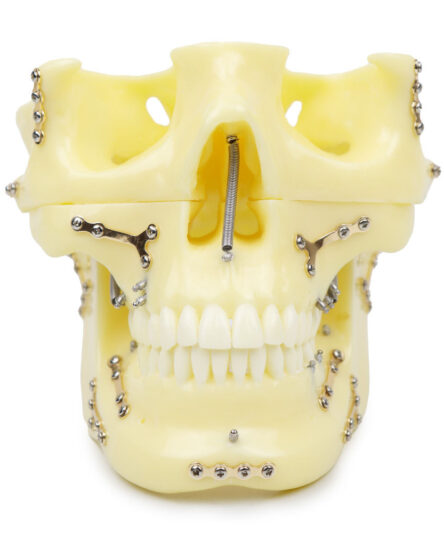 iDENTical Skull Education Model With Fracture And Restoration (M5004)