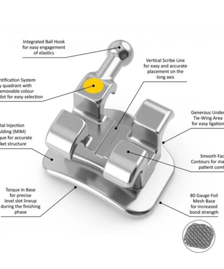 metal-bracket-kit-2