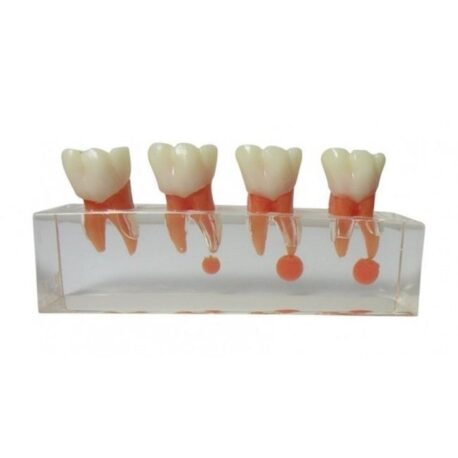 iDENTical Study Model Root Canal Treatment M 4018