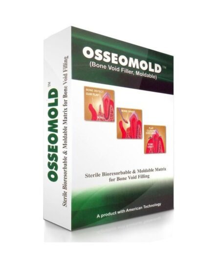 osseomold-advanced-biotech