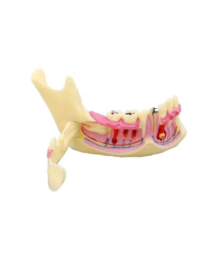 iDENTical Mandible Bone Model M4014