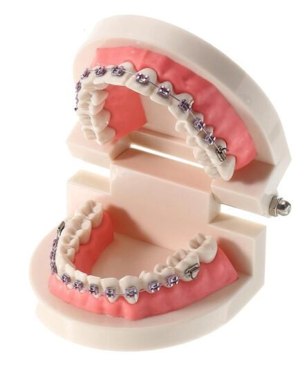patient-education-model-with-orthodontic-brackets-4