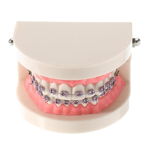 Patient Education Model With Orthodontic Brackets MD - 119