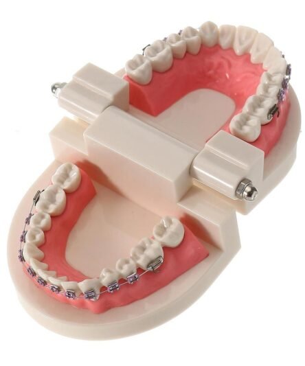 patient-education-model-with-orthodontic-brackets-4