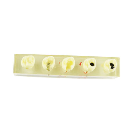 iDENTical Root Canal Model M4012