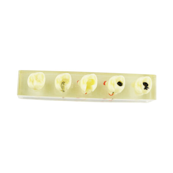 iDENTical Root Canal Model M4012