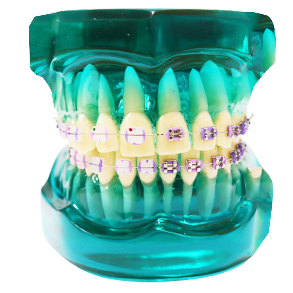 IDENTical Metal & Ceramic Brackets Orthodontic Model