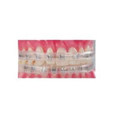 Maarc 5 Pcs Strips Relief Wax for Ortho