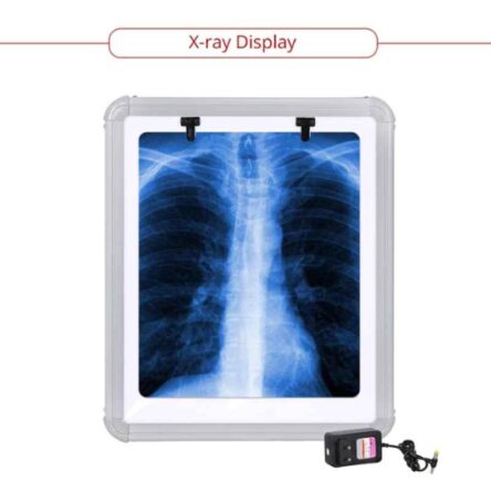 MCP 12V Single Film LED X-Ray Illuminator View Box
