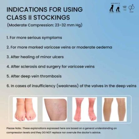 Sorgen Royale Microfiber Class 2 Thigh Length Medical Compression Stockings