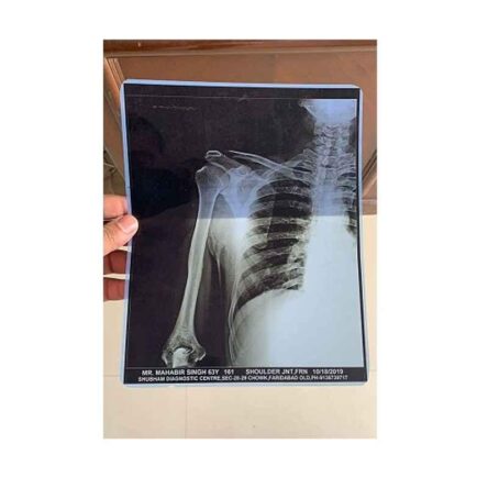 Epson 210 micron PET Inkjet X-Ray Film Printer with 100 Pcs 8×10 inch Film & 100 Pcs 8.5×11 inch Film