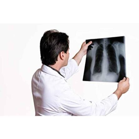 VMS HI-Speed 50 Sheets 6.5×8.5 inch Green Base Sensitive Conventional X-Ray Medical Film Set