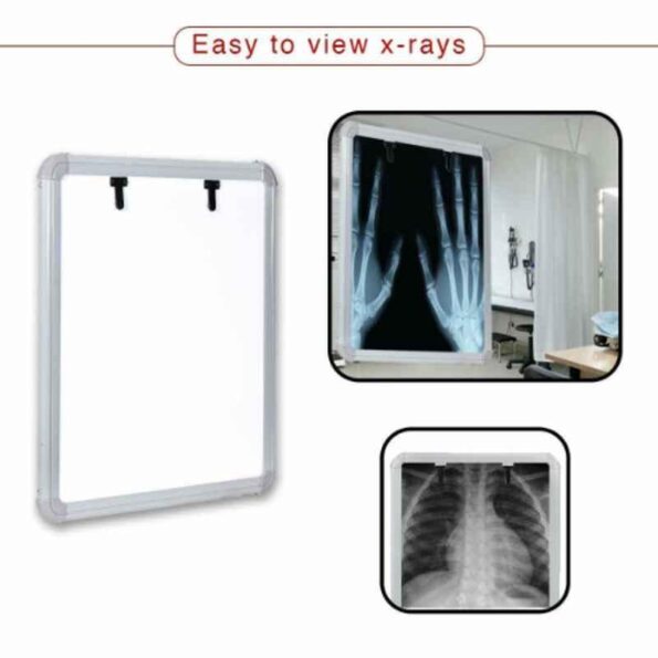 Divine Medicare 12V LED X-Ray Illuminator Single Film View Box with Automatic Film Activation