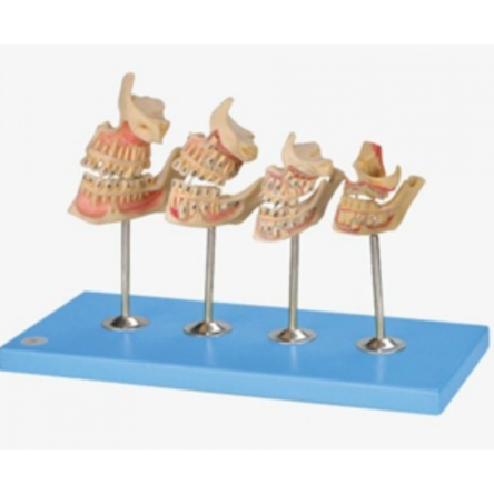 Development of a set of Teeth – Dental Model