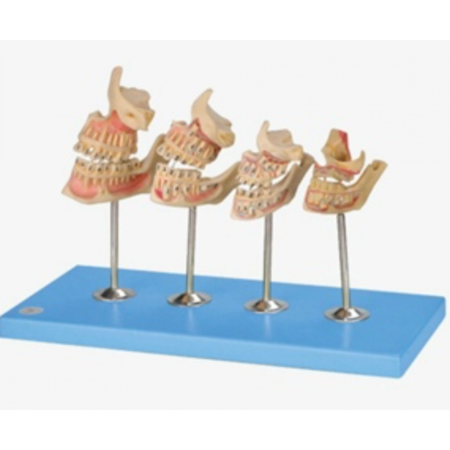 Development of a set of Teeth - Dental Model