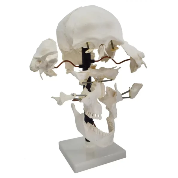 Exploded Human Skull Model - Divine Medicare