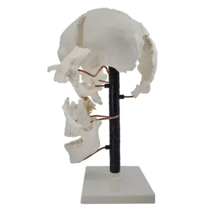 Exploded Human Skull Model – Divine Medicare