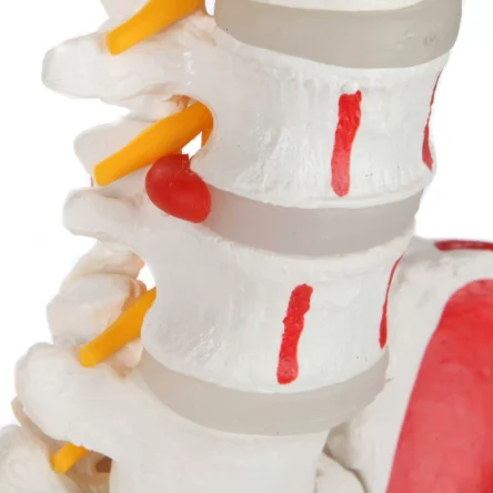 Flexible Spine Model With Femur Heads