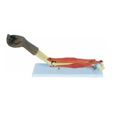 Functional Elbow Joint Model – Divine Medicare