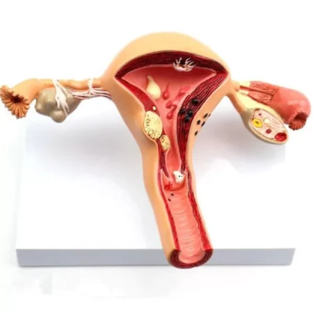 Uterus Ovary Anatomy Model With Extremely Precise Anatomical Details And Structures