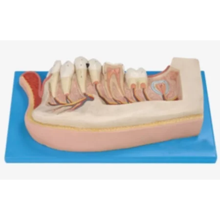 Lower Jaw Of 12-Year-Old Dental Model