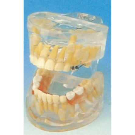 Milk Teeth Development Model