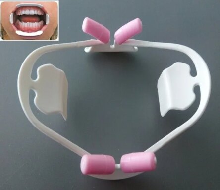 ET Dental Optiview 3D Cheek and lip Retractor