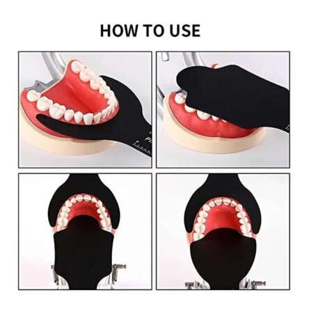 MCTBIO Photo Contrast – Upper (PTC-01)