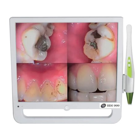 Ids Denmed Intra Oral Camera with Monitor HDI-999