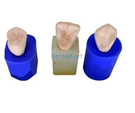 API Model Former – Teeth Enlarger # Lower Molar