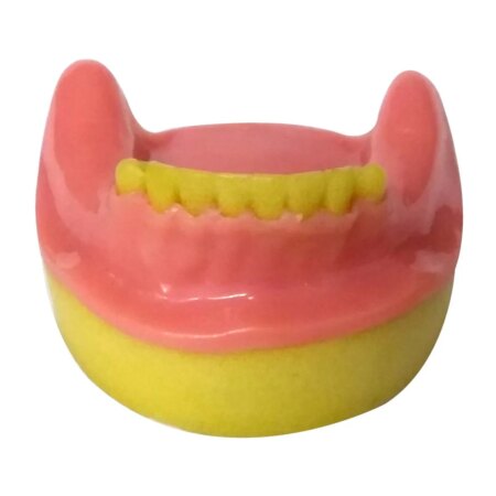 Dental Model Partially Edentulous Mandible MD-123