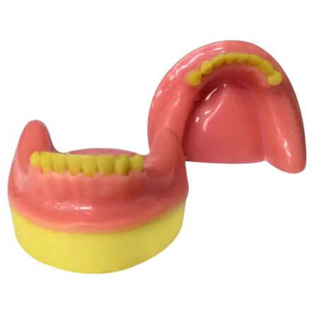 Dental Model Partially Edentulous Mandible MD-123