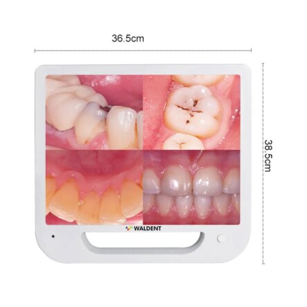 Waldent Intra Oral Camera with Screen – Ergo (10 MP)
