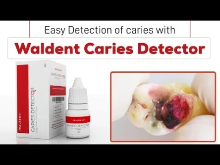 Waldent Caries Detector