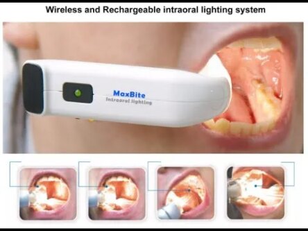 Waldent Maxbite Intraoral Lighting