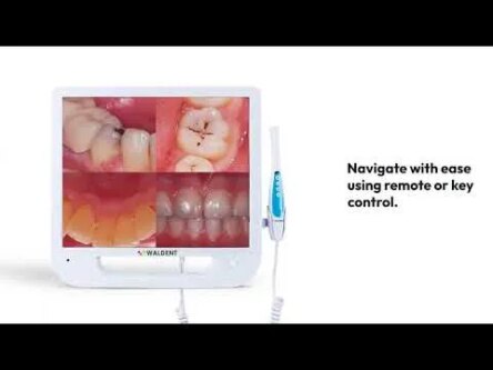 Waldent Intra Oral Camera with Screen – Ergo (10 MP)