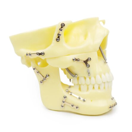 iDENTical Skull Education Model With Fracture And Restoration (M5004)