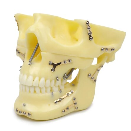 iDENTical Skull Education Model With Fracture And Restoration (M5004)