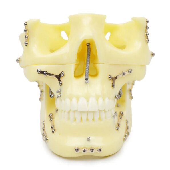 iDENTical Skull Education Model With Fracture And Restoration (M5004)