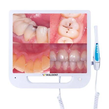Waldent Intra Oral Camera with Screen – Ergo (10 MP)