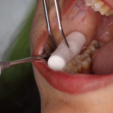 GDC Pmt Set Of 3 (Pmtwc3)