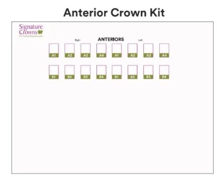 3M Paedodontic Zirconia Crowns Refill-A1-Anterior-Right