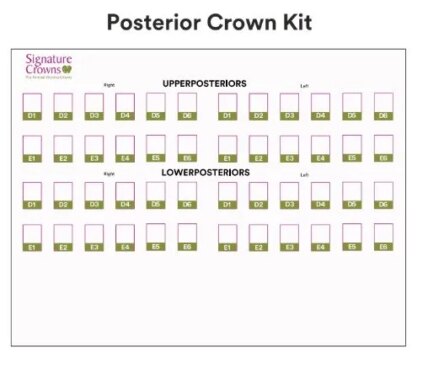 3M Paedodontic Zirconia Crowns Refill-A1-Anterior-Right