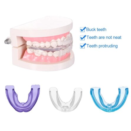 U Ortho Purple Retainer – Stage 3 (Hard)